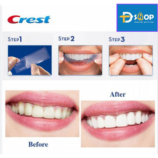 Miếng dán trắng răng Crest 3D Whitestrips nhiều loại