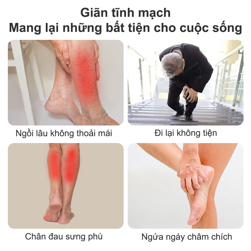 Kem suy giãn tĩnh mạch 20g giúp giảm đau mỏi tê phù chuột rút do suy giãn tĩnh mạch thúc đẩy tuần hoàn máu