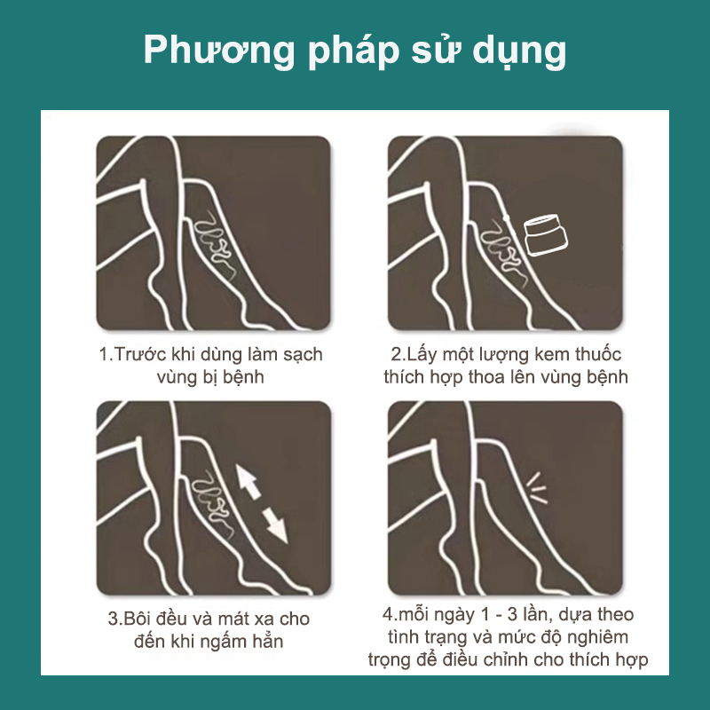 Kem suy giãn tĩnh mạch 20g giúp giảm đau mỏi tê phù chuột rút do suy giãn tĩnh mạch thúc đẩy tuần hoàn máu