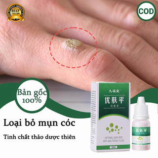 Thuốc mụn cóc Thuốc chấm mụn cóc Miếng dán mụn cóc 10ml Loại bỏ mụn cóc và mụn thịt hiệu quả Không bao giờ tái phát