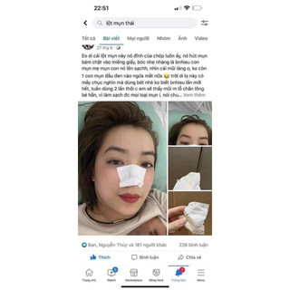 Gel lột mụn nha đam thái lan