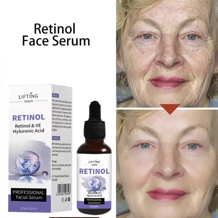 Serum Vitamin E siêu dưỡng trắng da giúp tái tạo da mặt làm sáng và căng bóng da ngăn ngừa lão hóa dachống thâm mắt và b