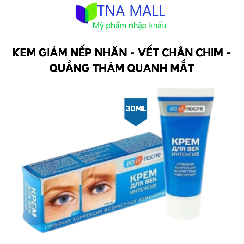 Kem dưỡng giảm thâm, làm mờ nếp nhăn, chân chim, trẻ hóa da vùng mắt Before and After Kpem Nga 30ml