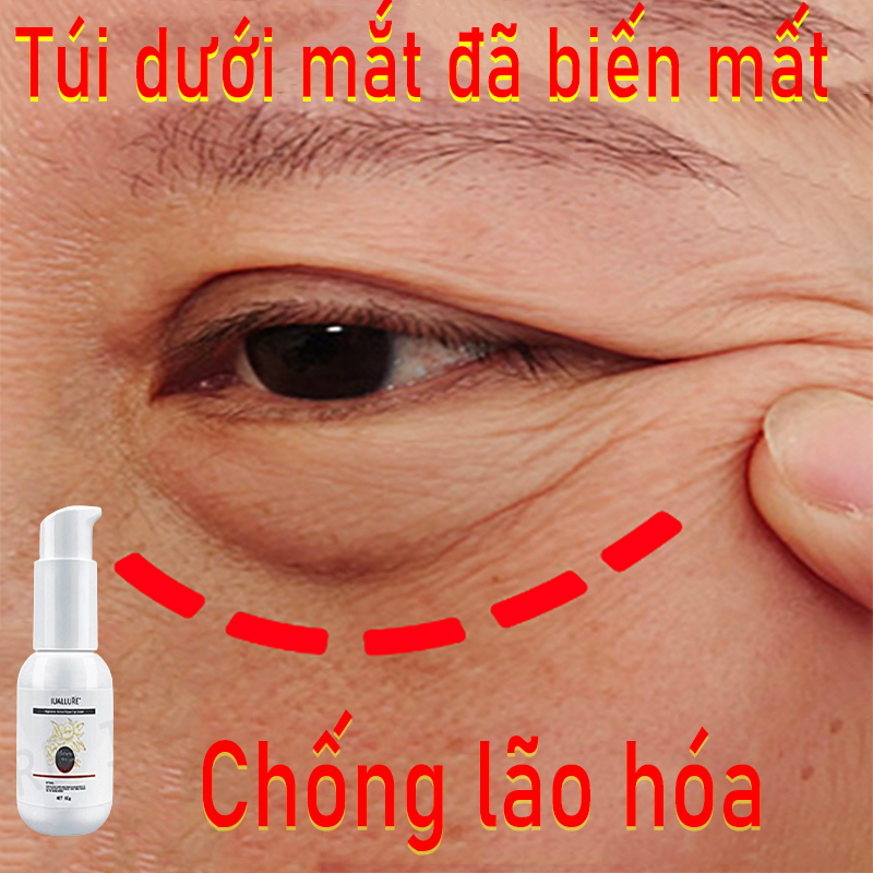 Kem nhăn mắt  kem xoá nhăn mắt  40g tinh chất chống lão loại bỏ các hạt mỡ loại bỏ quầng thâm