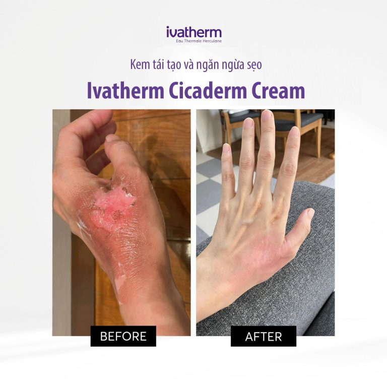 [HỎA TỐC] Kem dưỡng Ivatherm Cicaderm Creme phục hồi làm dịu da, ngăn hình thành sẹo 40ml