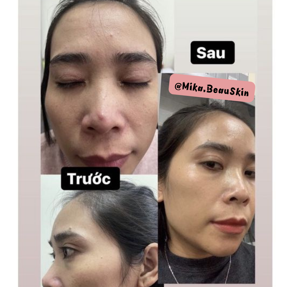 Kem Dưỡng Trắng Da Ban Đêm MELUMIN Anti-dark spots concentrated night cream