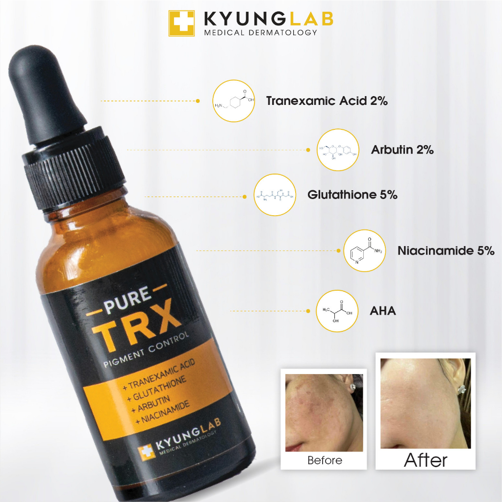 Serum nám KyungLab Pure TRX mờ nám tàn nhang dưỡng trắng da 30ml