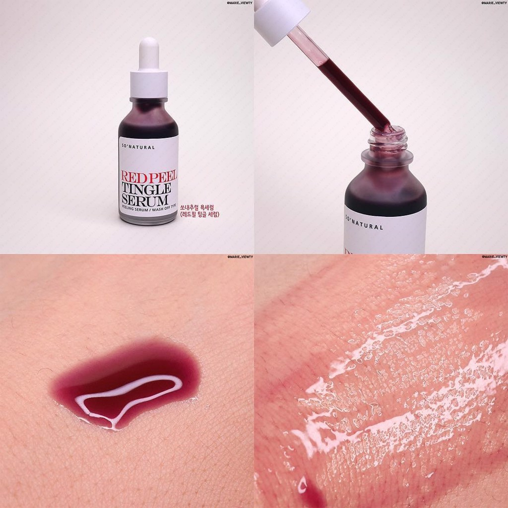 Serum So'Natural Red Peel Tingle Làm Giảm Mụn, Tái Tạo Làn Da 35ml