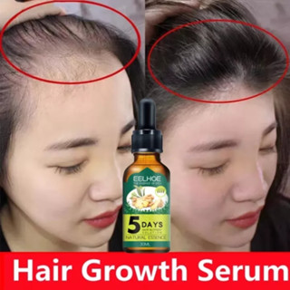 Thuốc mọc tóc serum mọc tóc tinh chất mọc tóc dưỡng tóc chống rụng tóc kích mọc tóc nhanh ph