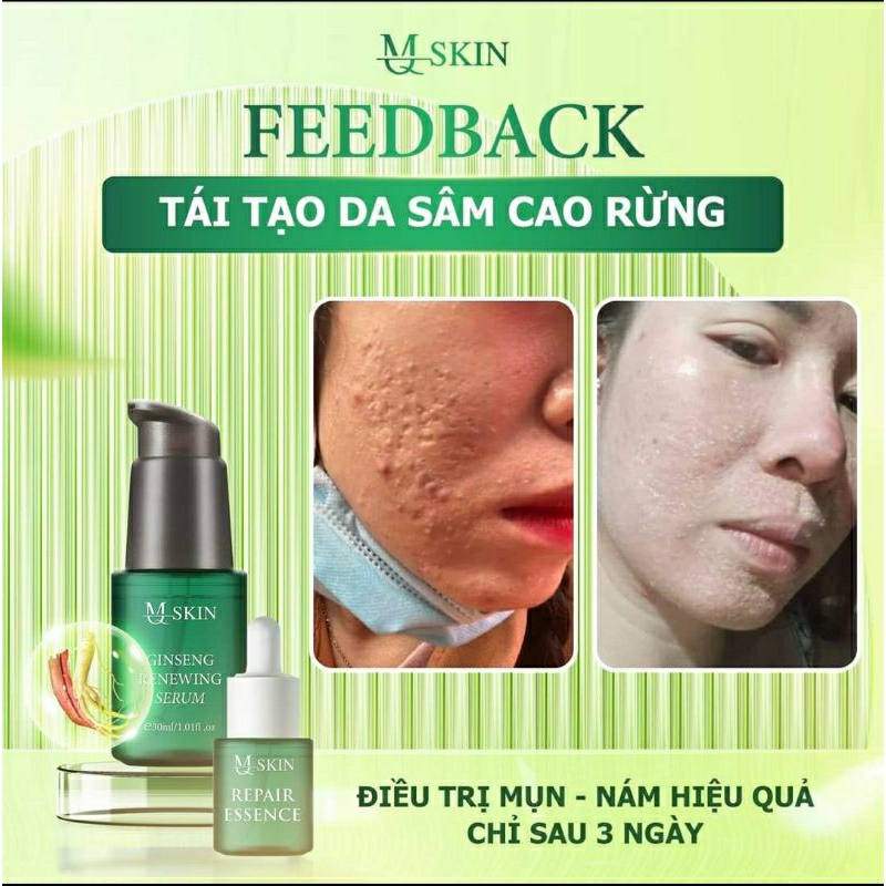 Serum Tái Tạo Da Sâm Cau Rừng MQ SKIN 30ML Giải Quyết Mụn Nám Tàn Nhang
