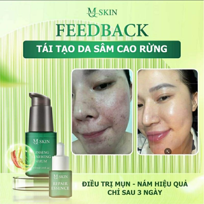 Serum Tái Tạo Da Sâm Cau Rừng MQ SKIN 30ML Giải Quyết Mụn Nám Tàn Nhang