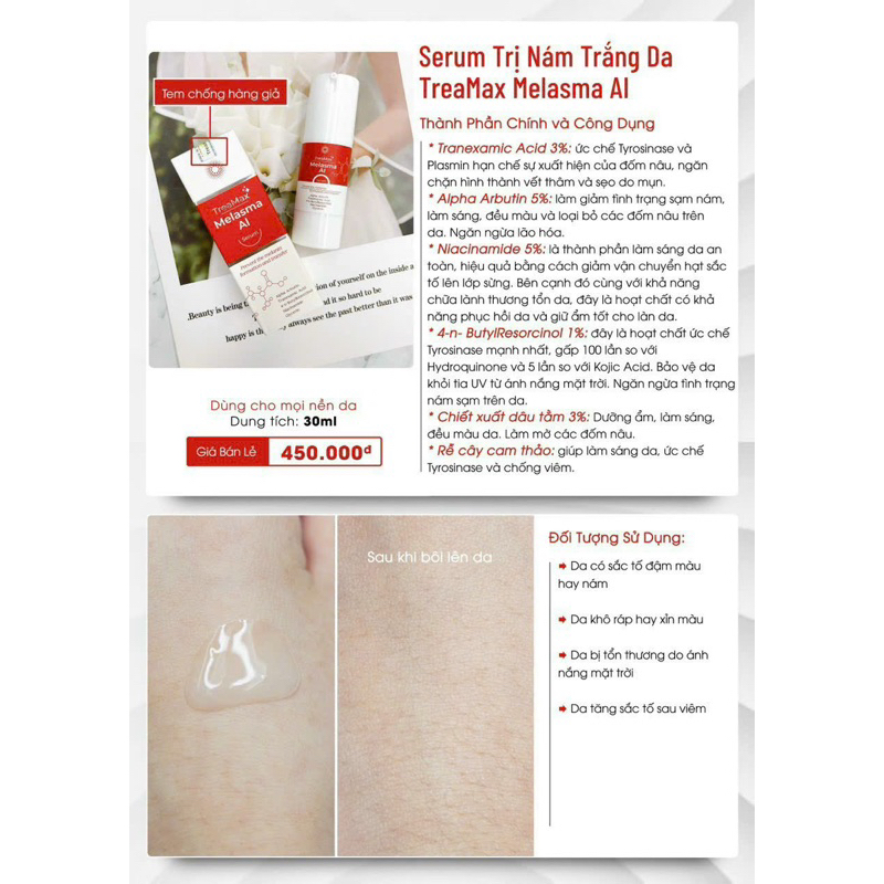 Serum Nám Trắng Da TreaMax Melasma AI 30ml