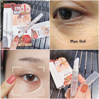 Gel bôi hỗ trợ giảm mụn thịt tsubuporon nhật bản