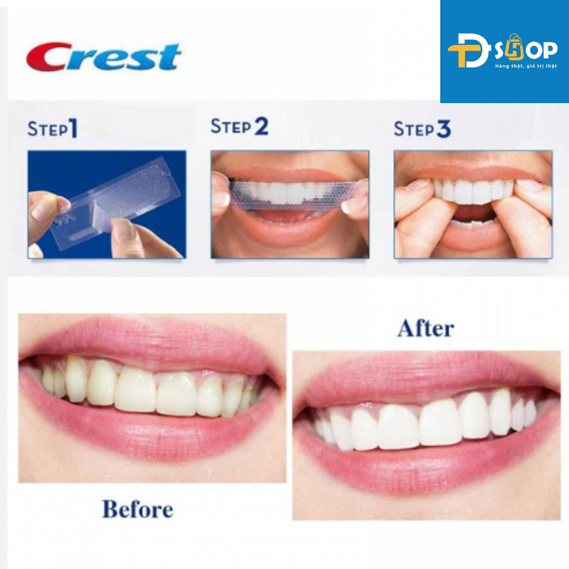 Miếng dán trắng răng Crest 3D Whitestrips nguyên hộp nhiều loại