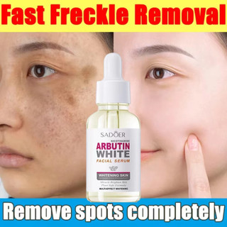 （HCM)Facial Serum The Ordinary Serum Nicotinamide Arbutin làm trắng da đẹp da mờ, Tinh Chất Serum Trắng Da , Mờ Thâm Nám