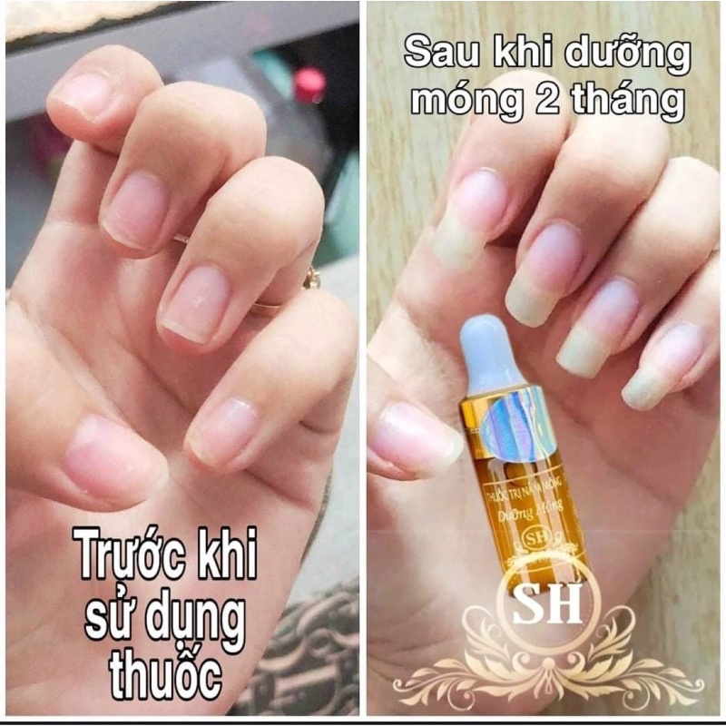 Serum đánh bay nấm móng hư khoé bọng móng nước ăn tay chân gia truyền