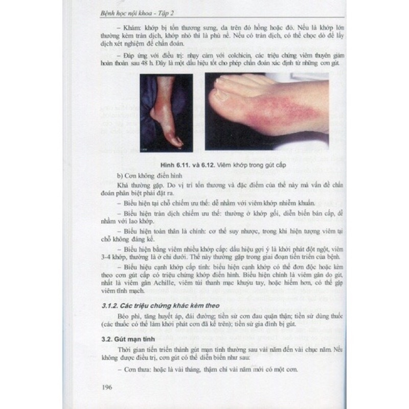 Sách - Bệnh học Nội khoa Tập 2- năm 2023