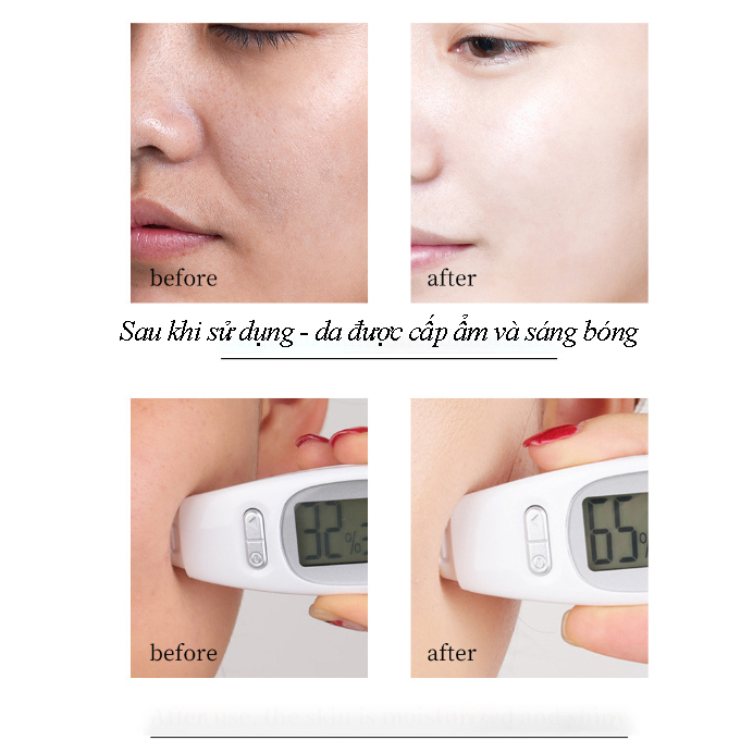 COMBO 20 Mặt Nạ Giấy SEOMOU Mặt nạ hoa quả BIG SALE MART M23-50