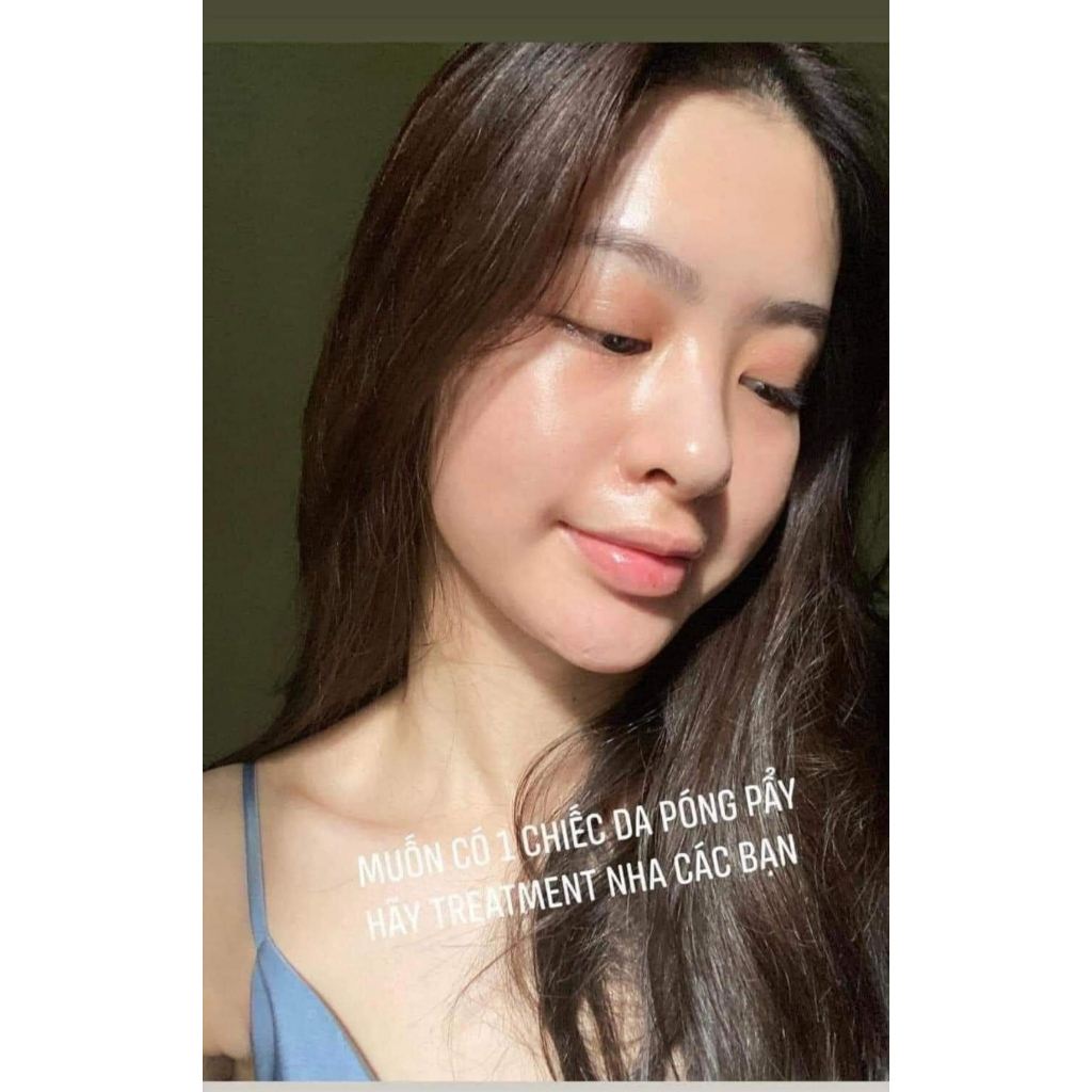 Thay da sinh học chuyên nghiệp MD TRANEX RETIPEEL