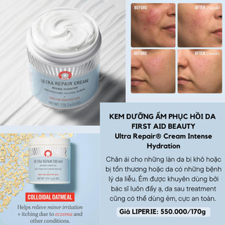 Kem dưỡng ẩm First Aid Beauty Ultra Repair Cream