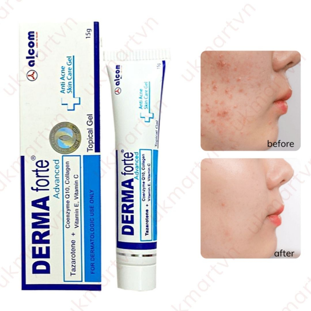 Gel Derma Forte giảm mụn, mờ thâm sẹo bản thường/ advanced 15g