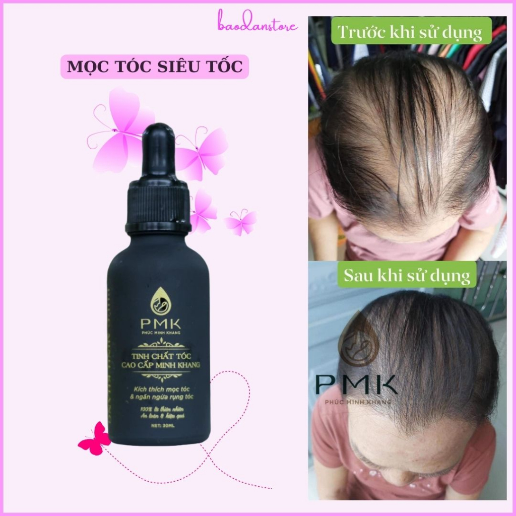 Tinh dầu dưỡng tóc Minh khang ❤️️FREESHIP❤️️ tinh chất mọc tóc siêu tốc,giảm rụng tóc, ngứa gàu-30ml