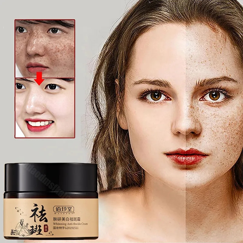 Kem xóa tàn nhang kem xóa nám làm trắng da tinh chất chất làm trắng da mặt và loại bỏ nám làm sáng da chăm sóc 30g kem n