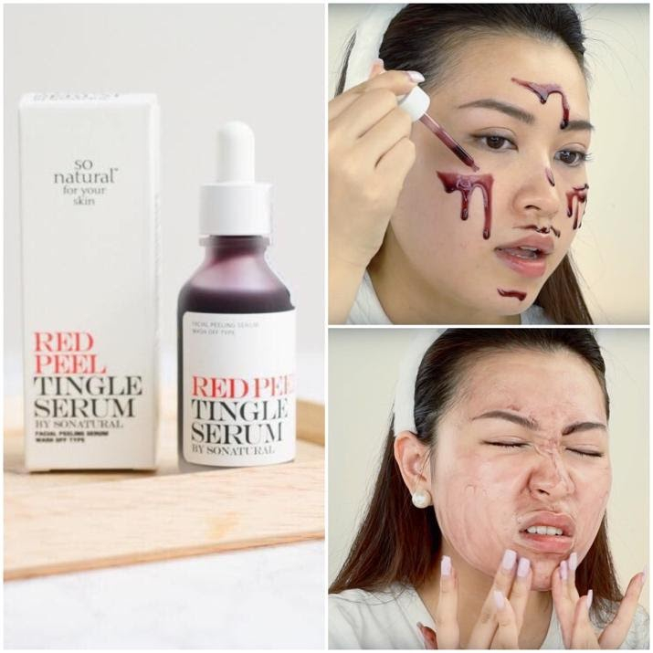 Serum tái tạo da Red Peel Tingle giúp giảm thâm và làm trắng da So Natural