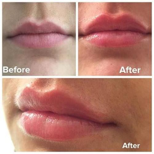 Son dưỡng môi chiết xuất tự nhiên Image Skincare Ormedic Lip Enhance Complex - Care For Skin 7g (new)