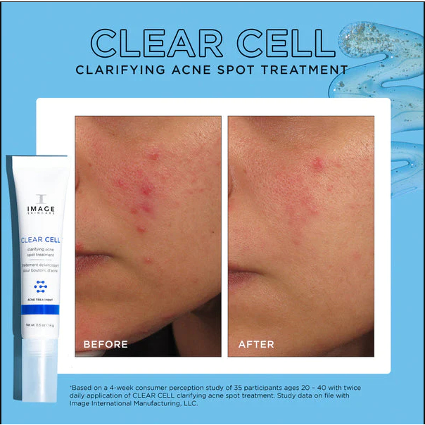 Gel chấm mụn và giảm viêm cấp tốc Image Clear Cell Clarifying Acne Spot Treatment Gel 14g