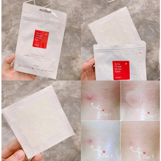 Dán mụn COSRX Acne Pimple Master Patch-Huyenmio