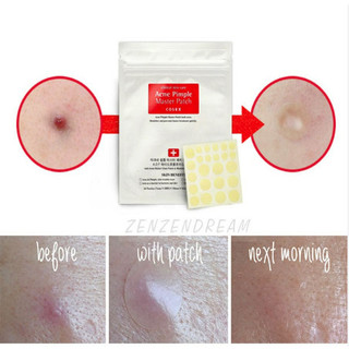 Dán mụn COSRX Acne Pimple Master Patch-Huyenmio