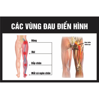Tranh spa đông y 3 tranh ( 40x60 x 3 tranh )