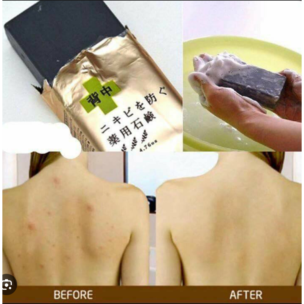 Xà Phòng Tắm Ngăn Ngừa và Làm Giảm Mụn Lưng Pelican For Back Soap Bar 135g Nội Địa Nhật Bản