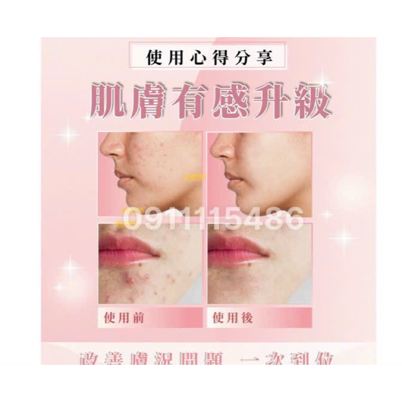 Kem Lyna Vàng Auth nhập 🇺🇸 nguyên Seal.