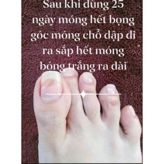 2chai đánh bay nấm móng (SH CHÍNH HÃNG)