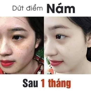 Combo serum và Bộ kem colagen Plus Vit E