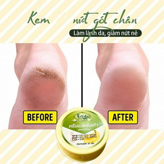 Kem chuối nứt gót chân Thái Lan 30g