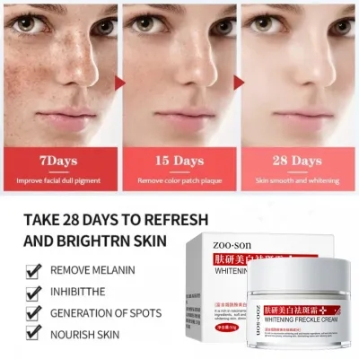 【Loại bỏ tàn nhang nhanh chóng】 Kem làm trắng da và loại bỏ tàn nhang, loại bỏ vết nám, làm mờ vết thâm, giảm tàn nhang, | BigBuy360 - bigbuy360.vn