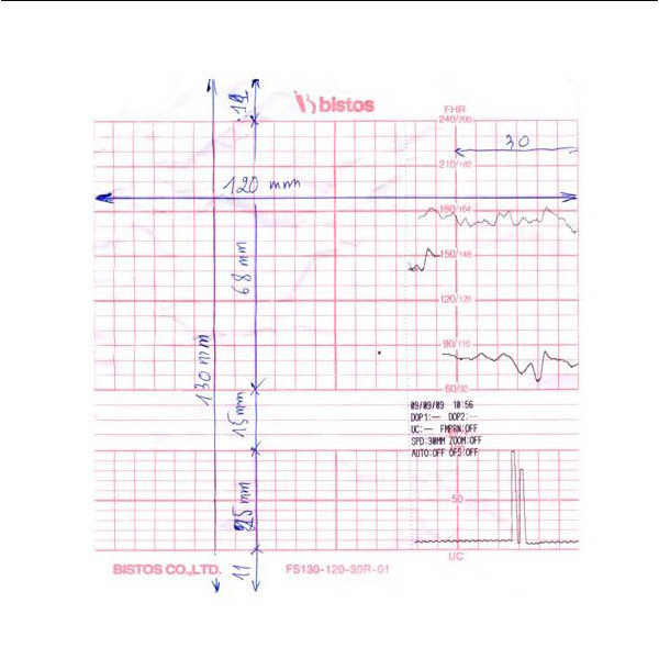 - Giấy monitor sản khoa Bistos BT-300, FS130-120-30R-01