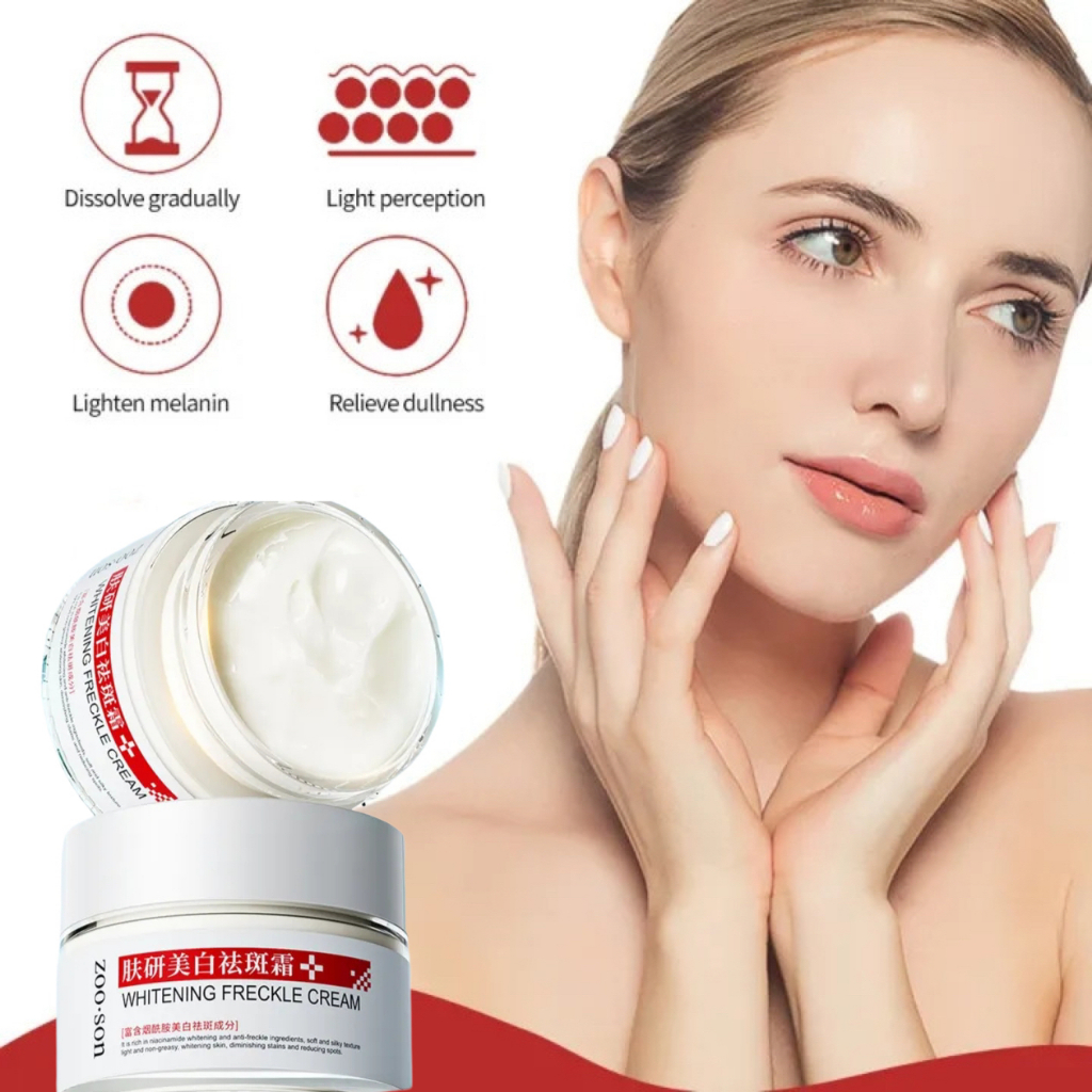 【Loại bỏ tàn nhang nhanh chóng】 Kem làm trắng da và loại bỏ tàn nhang, loại bỏ vết nám, làm mờ vết thâm, giảm tàn nhang, | BigBuy360 - bigbuy360.vn