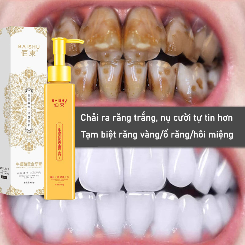 kem đánh răng làm trắng răng xóa sạch ố vàng mảng bám loại bỏ hôi miệng thơm mát hơi thở phòng chống sâu răng chắc khỏe