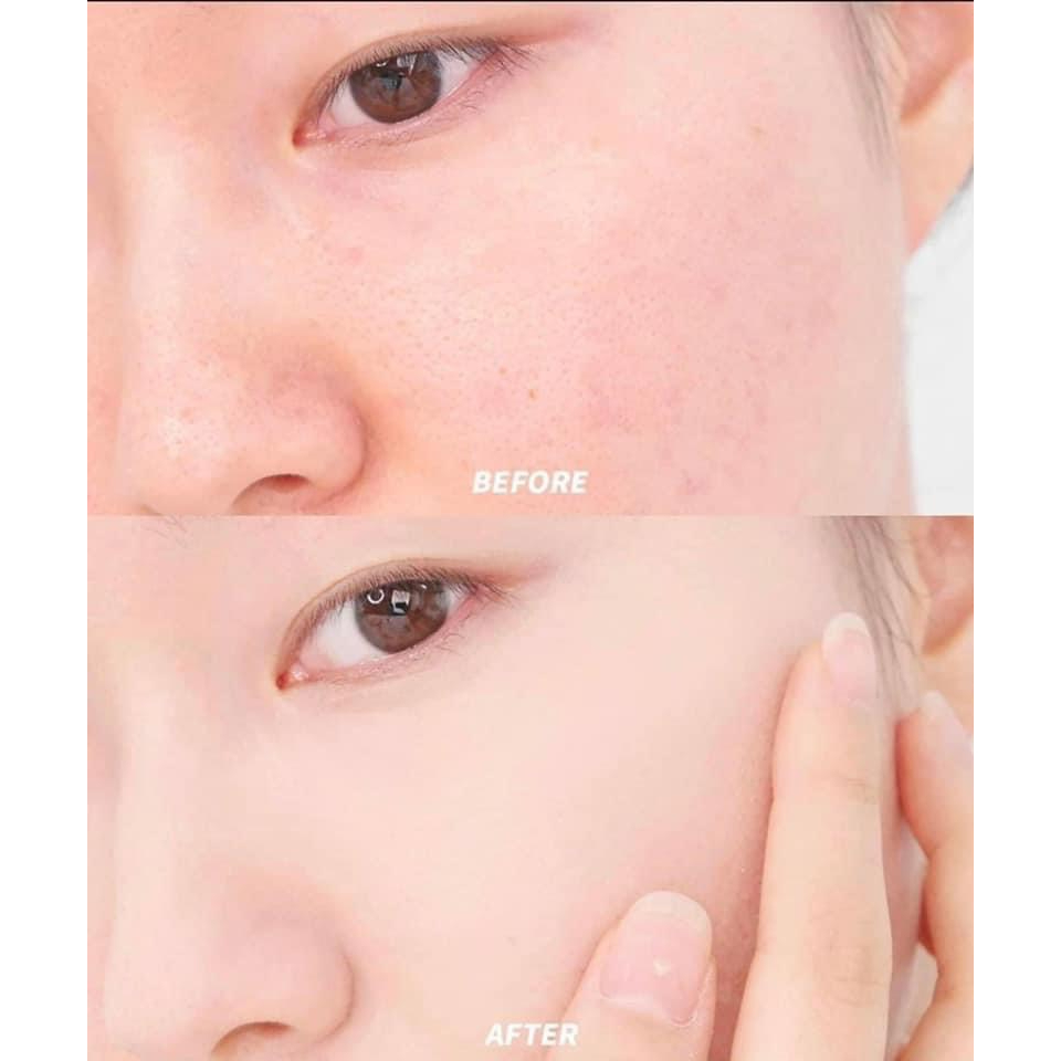 Che Khuyết Điểm Dior Cao Cấp - Dior Forever Skin Correct 11ml