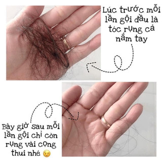 Dầu gội Biotin collagen tím