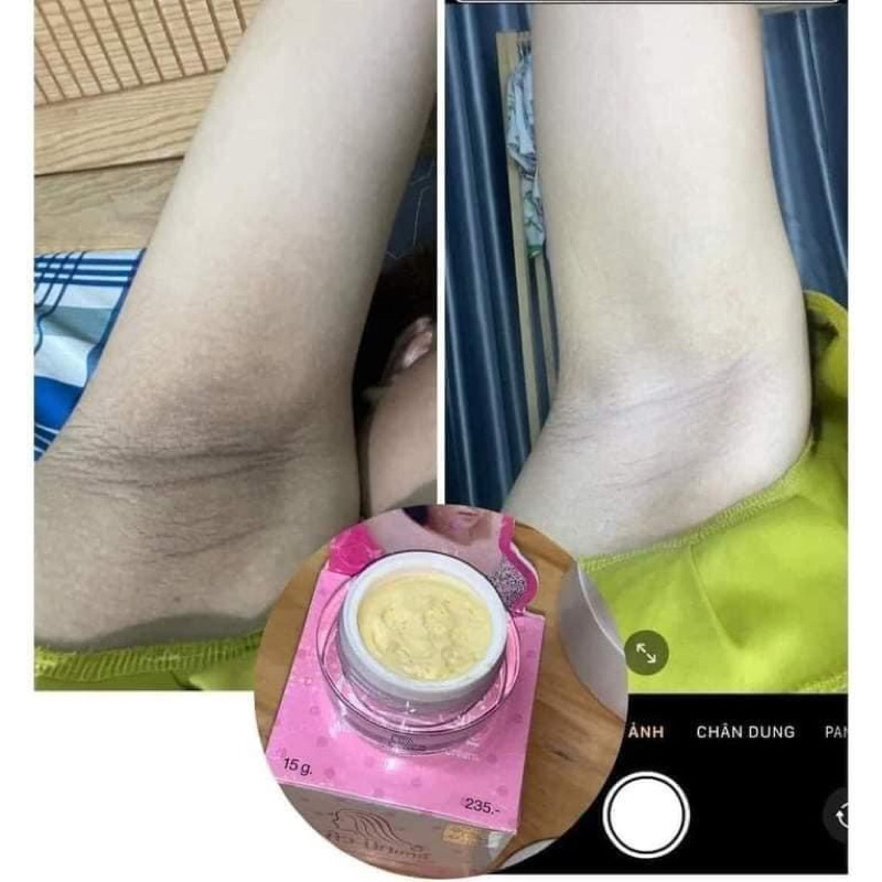 Kem Thâm Nách Qnic Care Thái Lan Chính Hãng