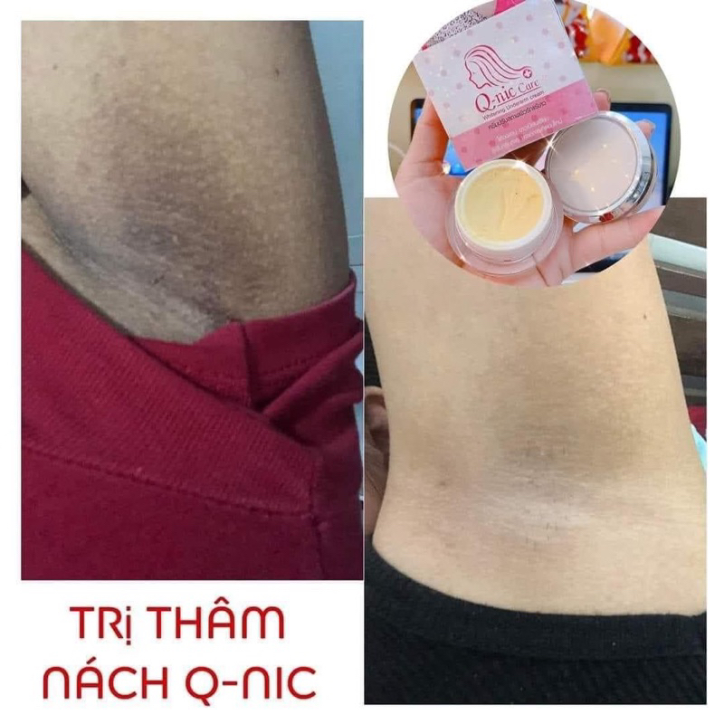 Kem Thâm Nách Qnic Care Thái Lan Chính Hãng