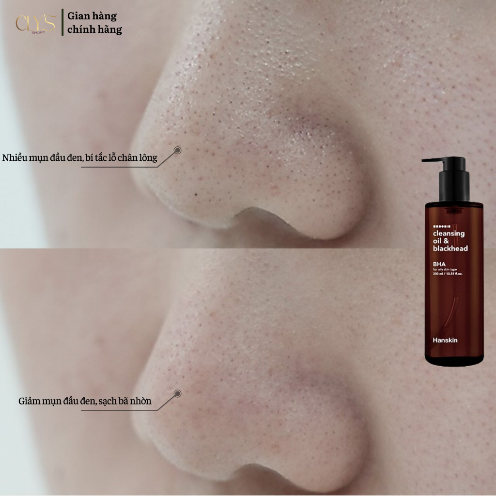 Dầu Tẩy Trang  Hanskin Tẩy Tế Bào Chết Dành Cho Da Dầu Cleasing Oil BHA Hàn Quốc - 300ml