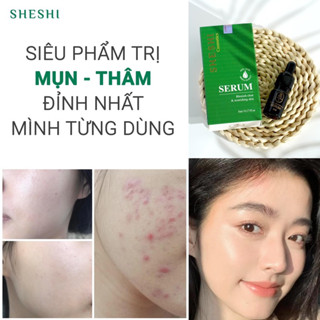 [Date 2.25] SERUM GIẢM THÂM MỤN SHESHI - dạng lỏng,mùi thơm dễ chịu,ko rít hiệu quả nhanh