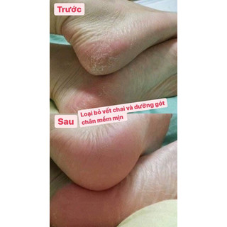 Set dưỡng chân Balea