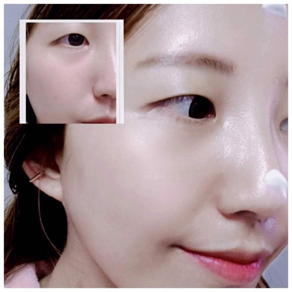 Set Dưỡng Da Chuyên Sâu Chống Lão Hóa Bakuchiol Mastinal Chính Hãng Hàn Quốc | Xù Korea